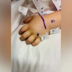 3-Year-Old Girl Bitten by Rattlesnake Hidden Under Amazon Package in California