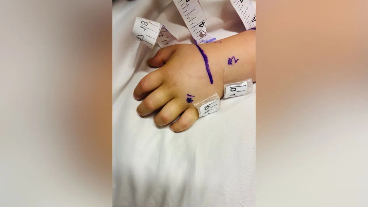 3-Year-Old Girl Bitten by Rattlesnake Hidden Under Amazon Package in California